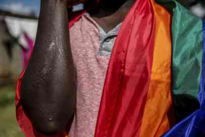 © Brian Inganga, AP | File photo: Ugandan gay refugee Martin Okello shows the scars he suffered in a homophobic attack, outside a home he shares with other LGBT refugees, Nairobi, Kenya, June 11, 2020.